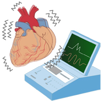 不整脈の診療