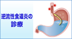 奈良市 内科 循環器内科 逆流性食道炎の治療