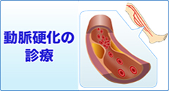 奈良市 内科 循環器内科 動脈硬化の治療